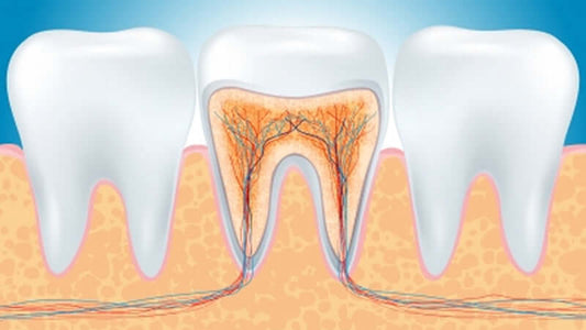 Root Canal Cover-Up
