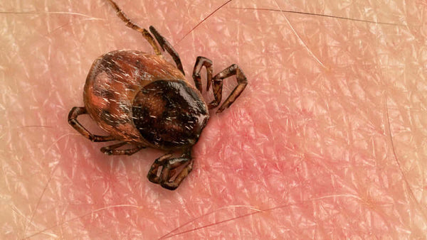 Lyme Disease Origins