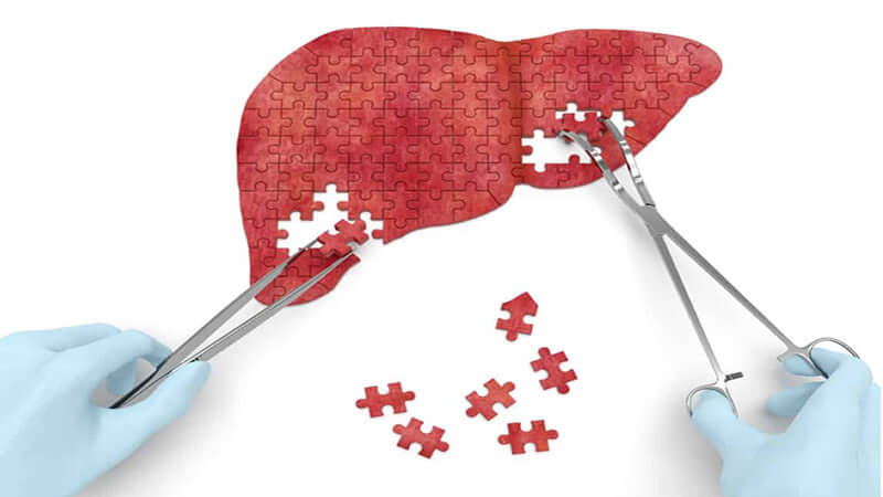 Testimonials: Cleanse for Hepatitis