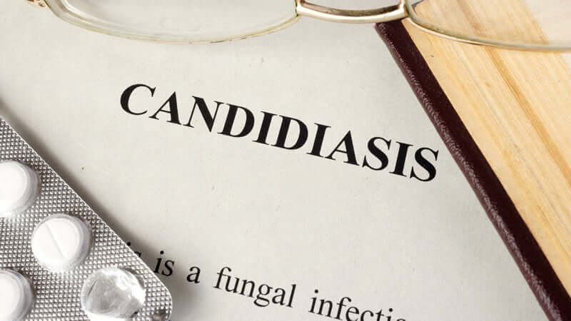 Candida: America's Silent Plague