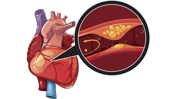 Heart Disease by Dr Stephen Terras