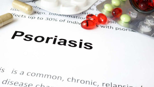 Psoriasis Risk Factors, Prevention and Tips