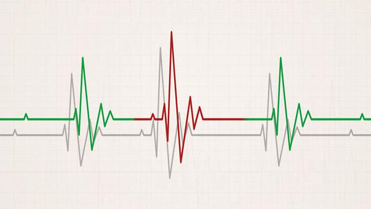 Electrocardiogram illustrating heart activity related to Magnesium and Postmenopausal Heart.
