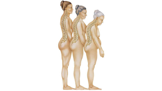 Osteoarthritis and Arthritis