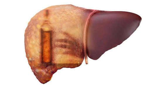 Primary Biliary Cirrhosis