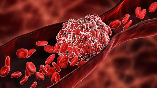 Image illustrating blood clots with red blood cells, related to Magnesium and Blood Clots.