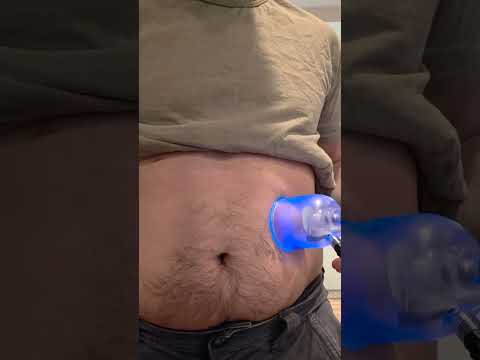 UV Reset Demo Video